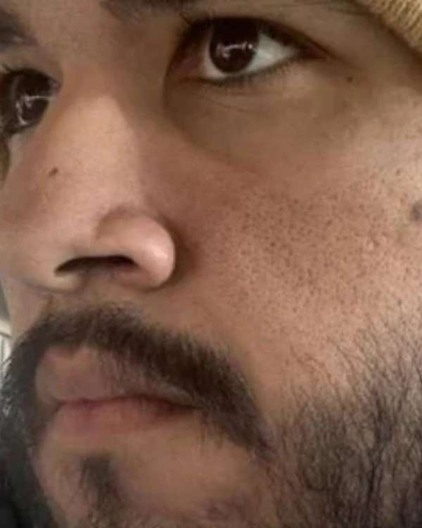 Después